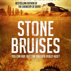Free Shipping Stone Bruises