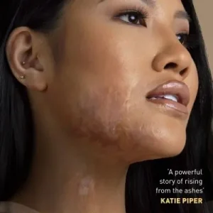 In My Skin Sale